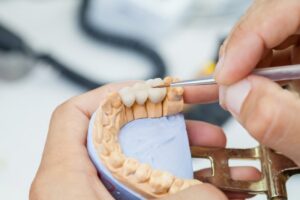 Closeup on bite impression with dental crowns. 